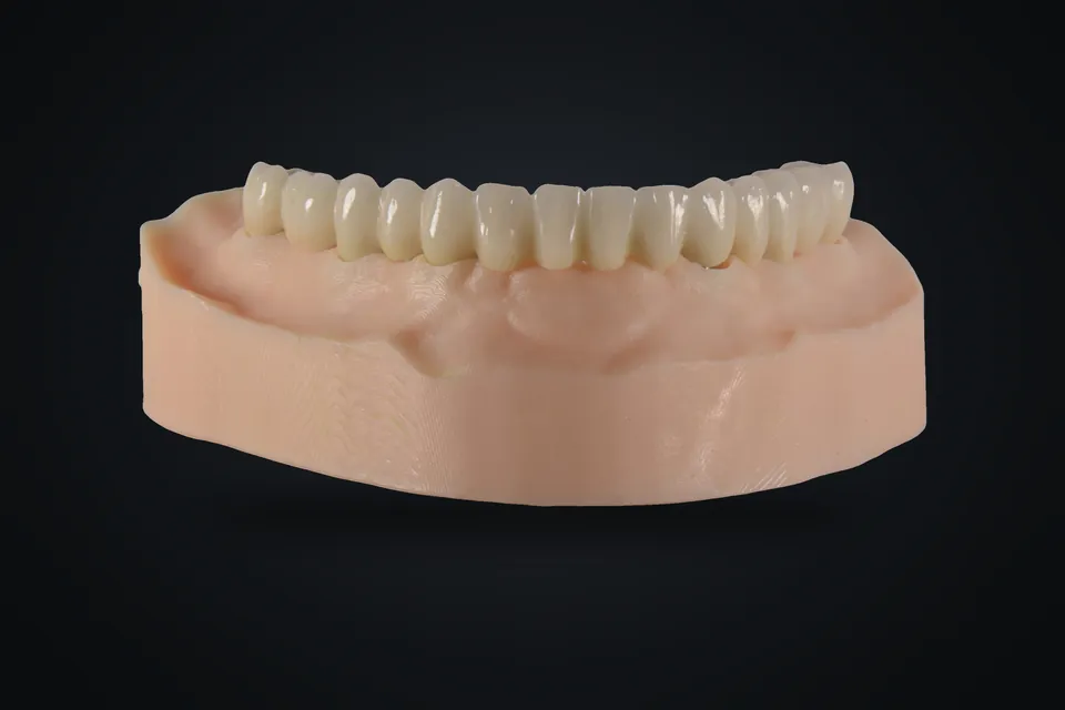 Baskı model üzerinde diş dizimi