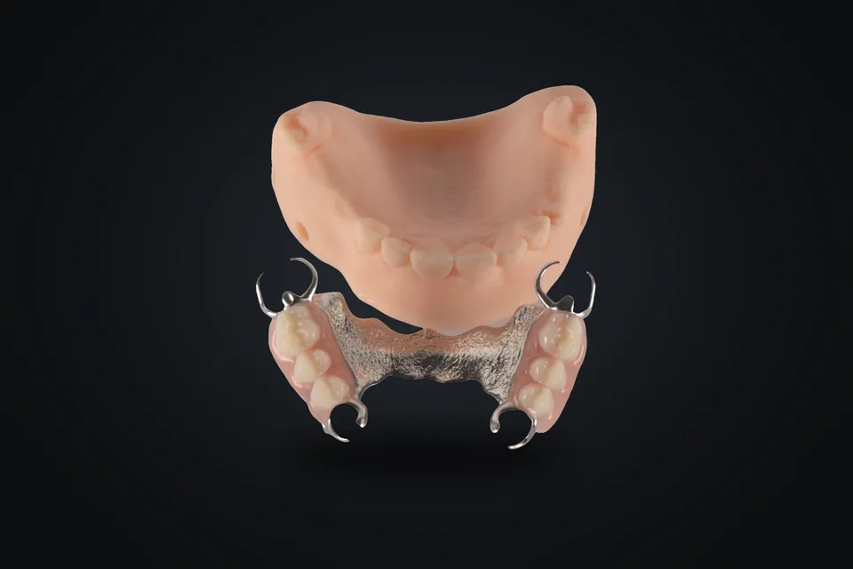 3D baskı model ve iskelet protez